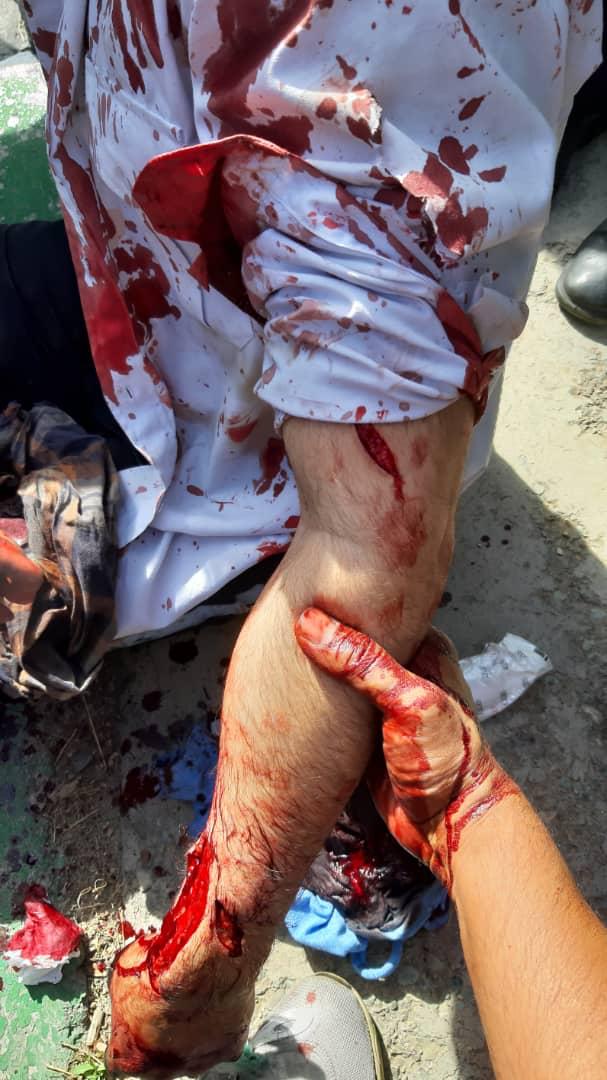 چاقو خوردن افسر راهور در تهران