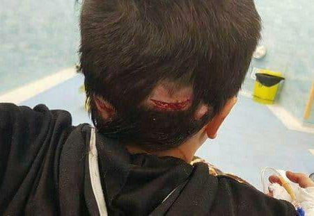 حمله سگ ولگرد به کودک 11 ساله تبریزی