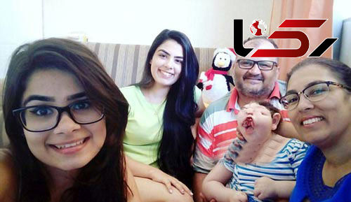 بیماری بسیار ترسناک این دختر بچه او را شبیه به هیولا کرد+ تصاویر دلخراش\
