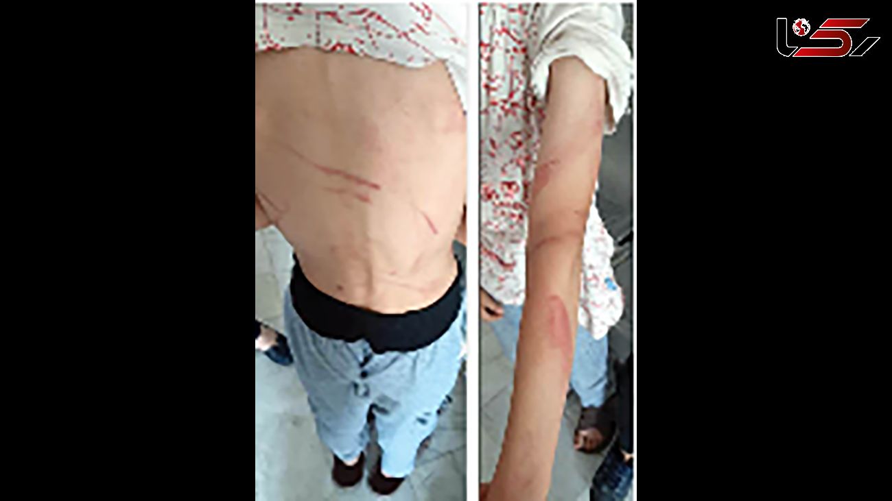 شلاق زدن کودکان دوقلو توسط مادر مشهدی ! + عکس تکاندهنده