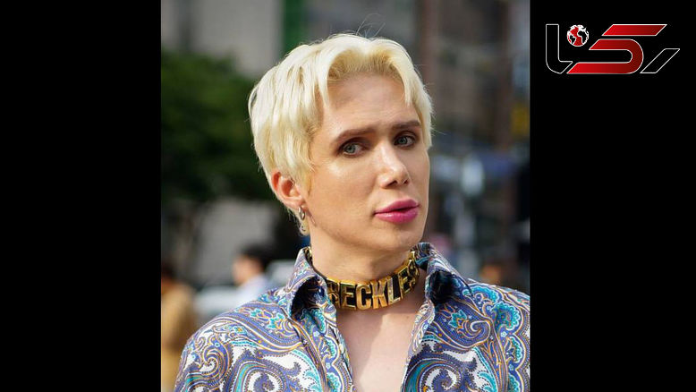 15 عمل جراحی برای شباهت به خواننده مورد علاقه+عکس