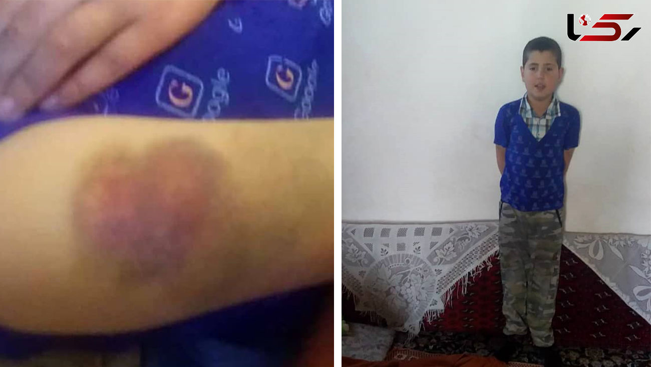 عذرخواهی معلم قزوینی به خاطر تنبیه شاگردش + فیلم گفتگوی اختصاصی