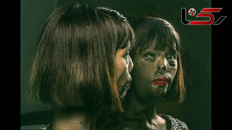 زشت ترین خانم مدل جهان چه سرنوشت شومی داشت! / پدر صورتش را با اسید سوزاند!+عکس